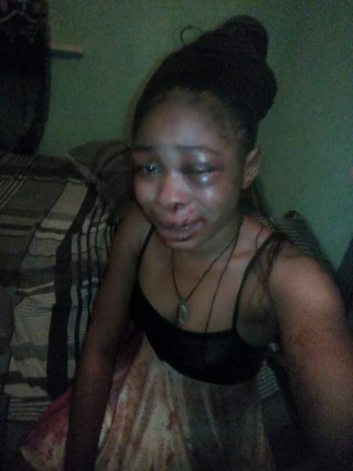 Woman Hospitalized After Husband Brutalized Her For Refu